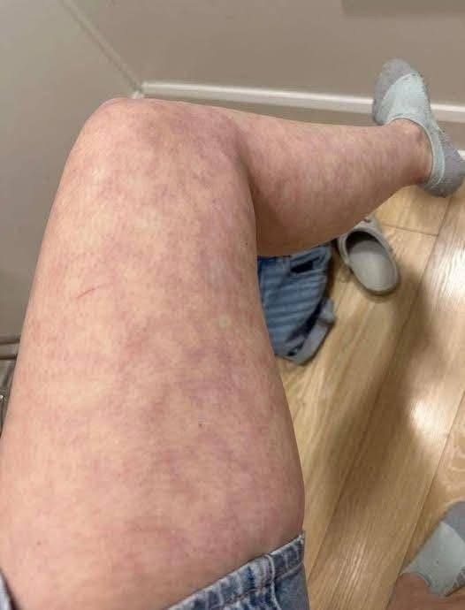 These are the consequences of sleeping with the… See below