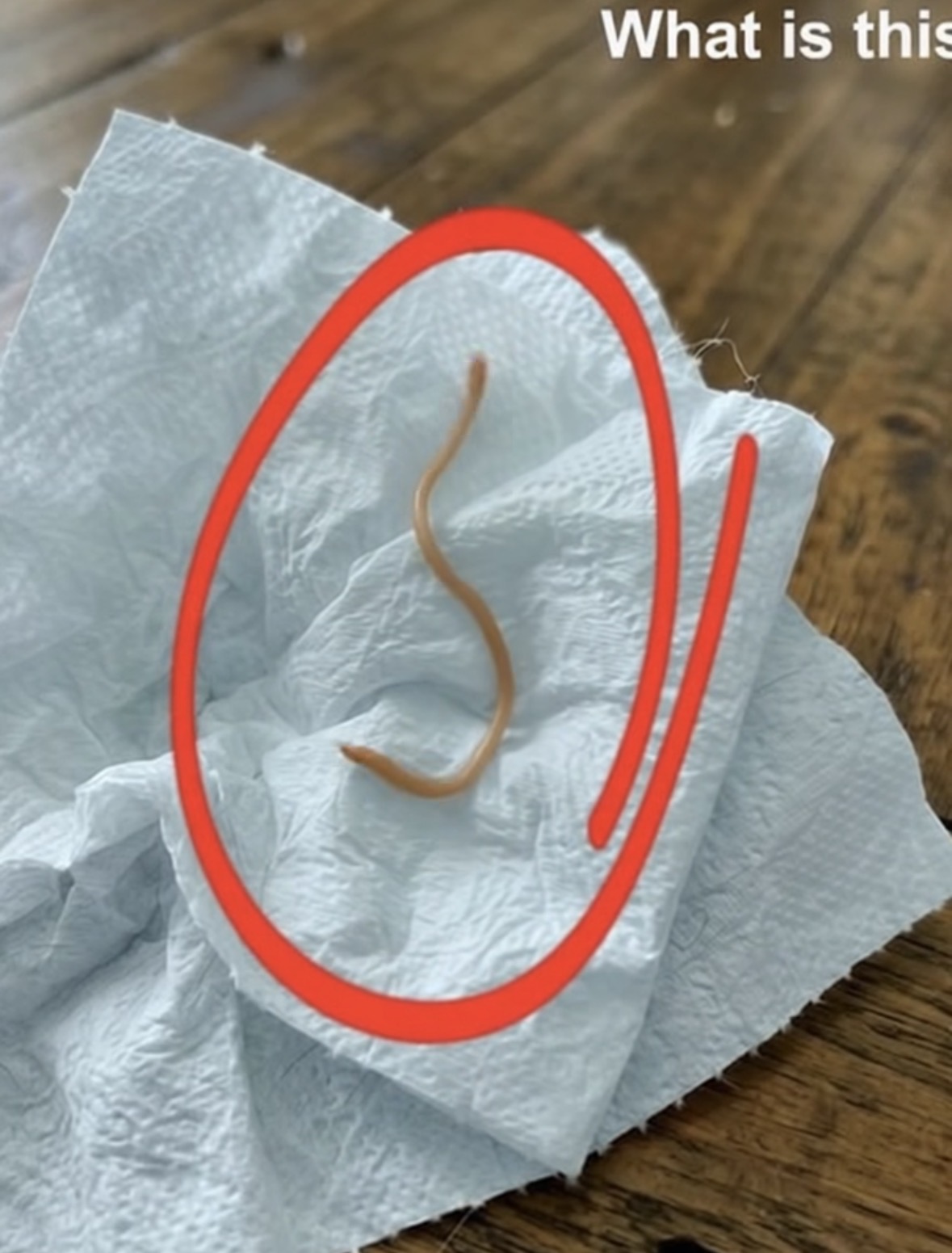 I went to the store to buy pork ribs and came home to cook them. I started frying them in a pan, and after a while, I suddenly noticed this on the meat. I carefully picked it up and placed it on a paper towel. Honestly, I immediately lost my appetite. I started examining it closely, trying to understand what it was, but with no success. Does anyone know what this is? Check the first comment for the answer 👇