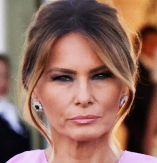 Melania face detail exposed… and it confirms the rumors were true 😮