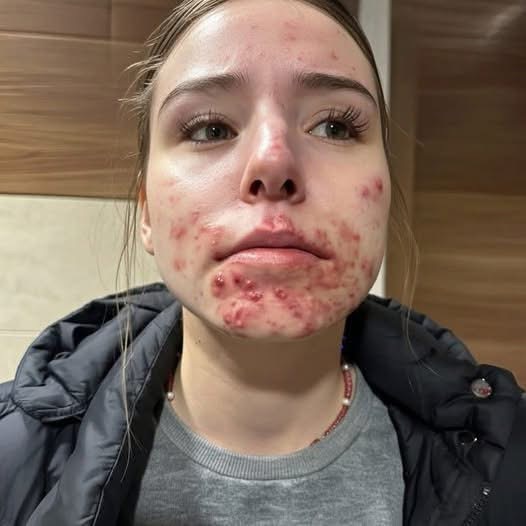 These are the consequences of sleeping with a… See below®