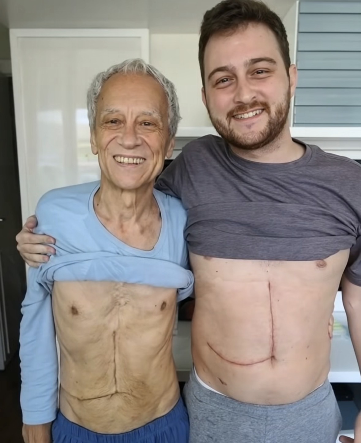Son who donated part of his liver to his father unfortunately ends up fa… See below