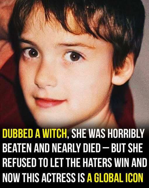 As a kid, she was violently bullied for her thrifted suit and short haircut. Once, the haters slammed her head into a locker started to kick the s*** out her 😢💔 Yet she refused to be silenced and today, the whole world knows who she is.. Her incredible story and name is in the comments 👇🏻