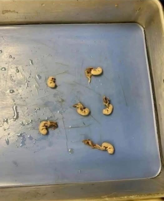 They look like little seeds but they are.. See below👇👇..