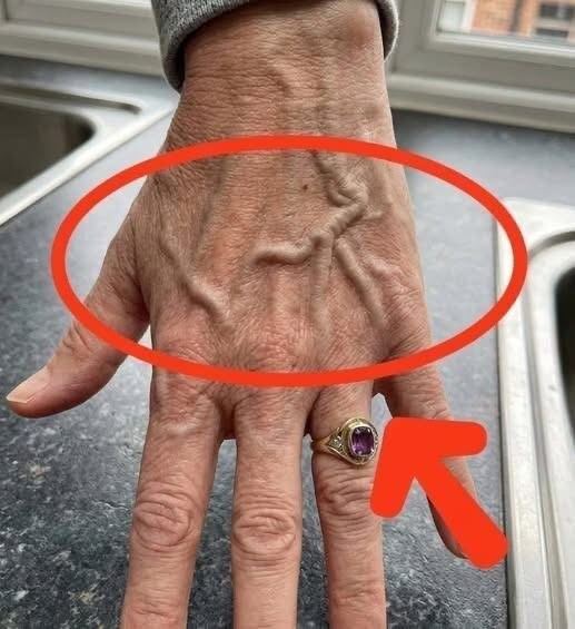 If you have visible veins, it means you are… Check 1st Comment 👇👇