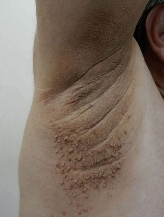 These are the first symptoms of cr…See below