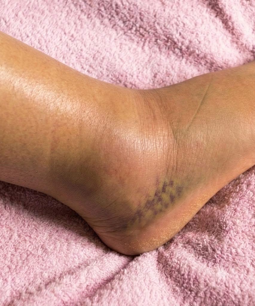 If you notice your legs are swollen, that’s a sign of ca… See more👇