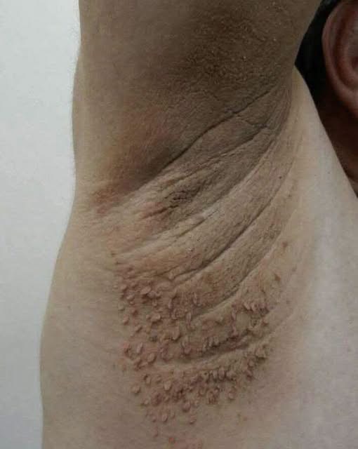 These are the first symptoms of cr…See more