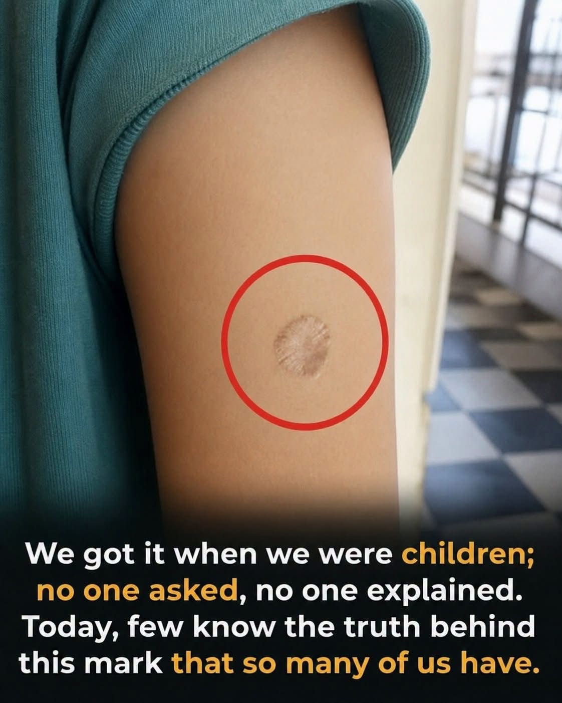 A Tiny Mark From Our Childhood Holds A Story Many People Never Knew… Read more below;👇