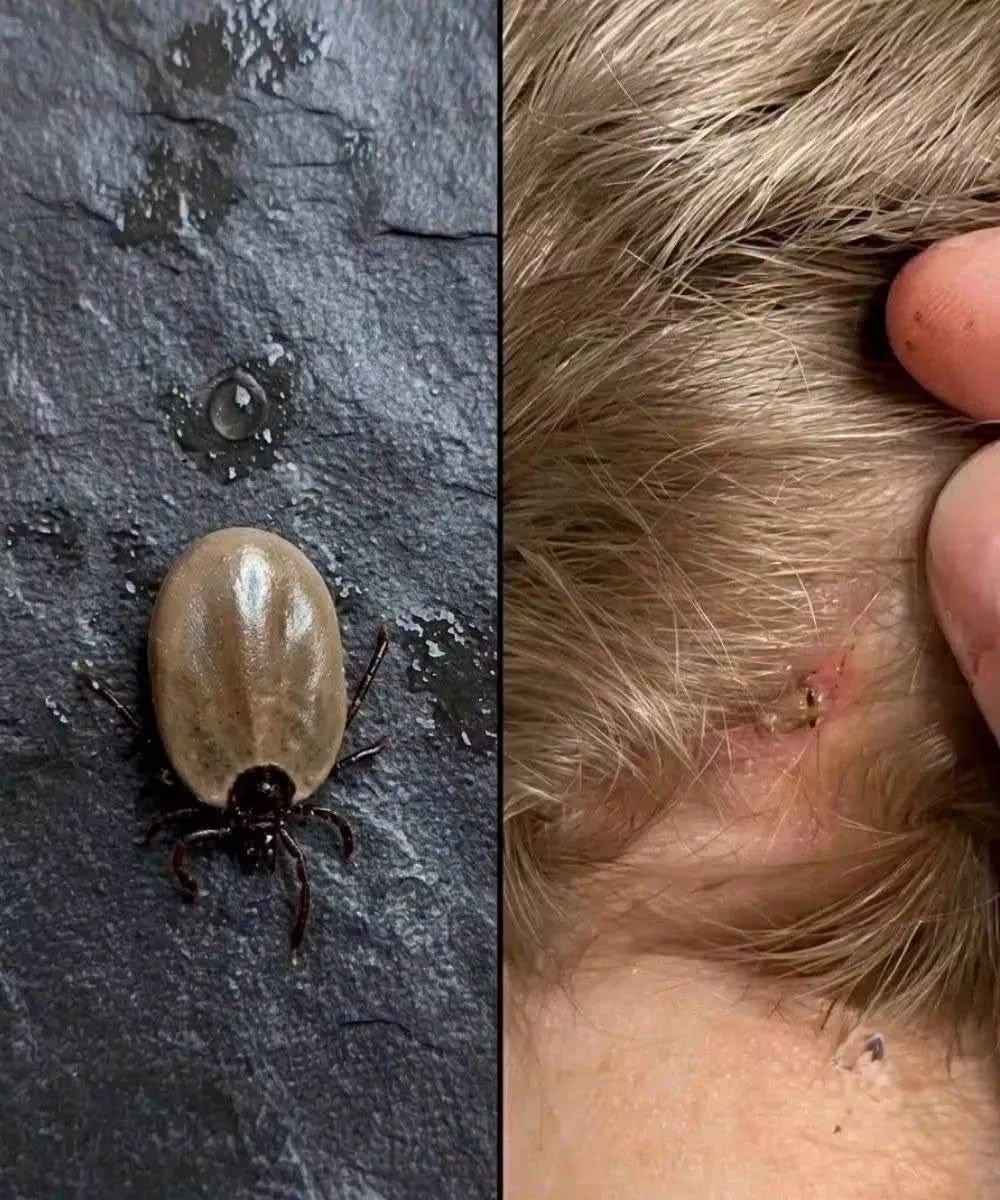 Does anyone know what kind of insect this is? I just found it on my son’s head… Check 1st comment 👇👇