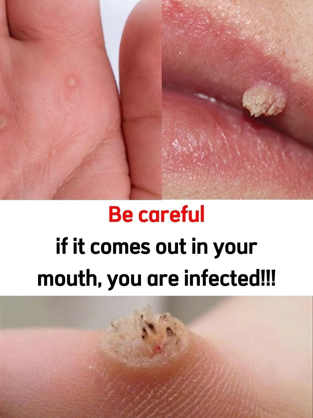 These are the first signs of an enf…See more…