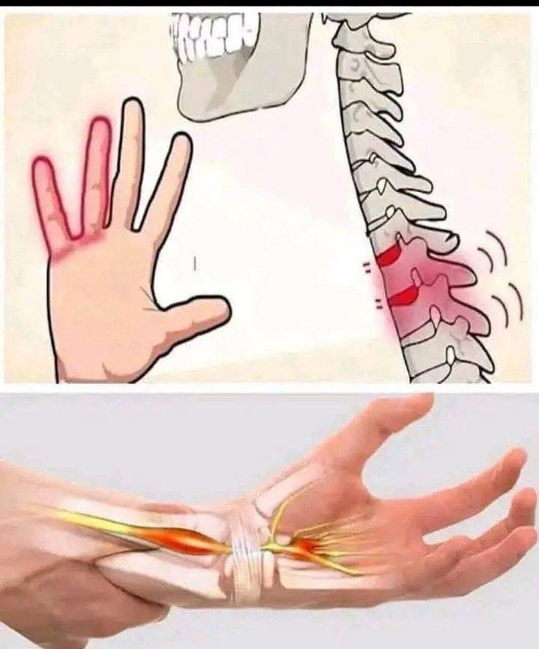 If your HANDS fall asleep it’s a clear sign that you have ca…See more