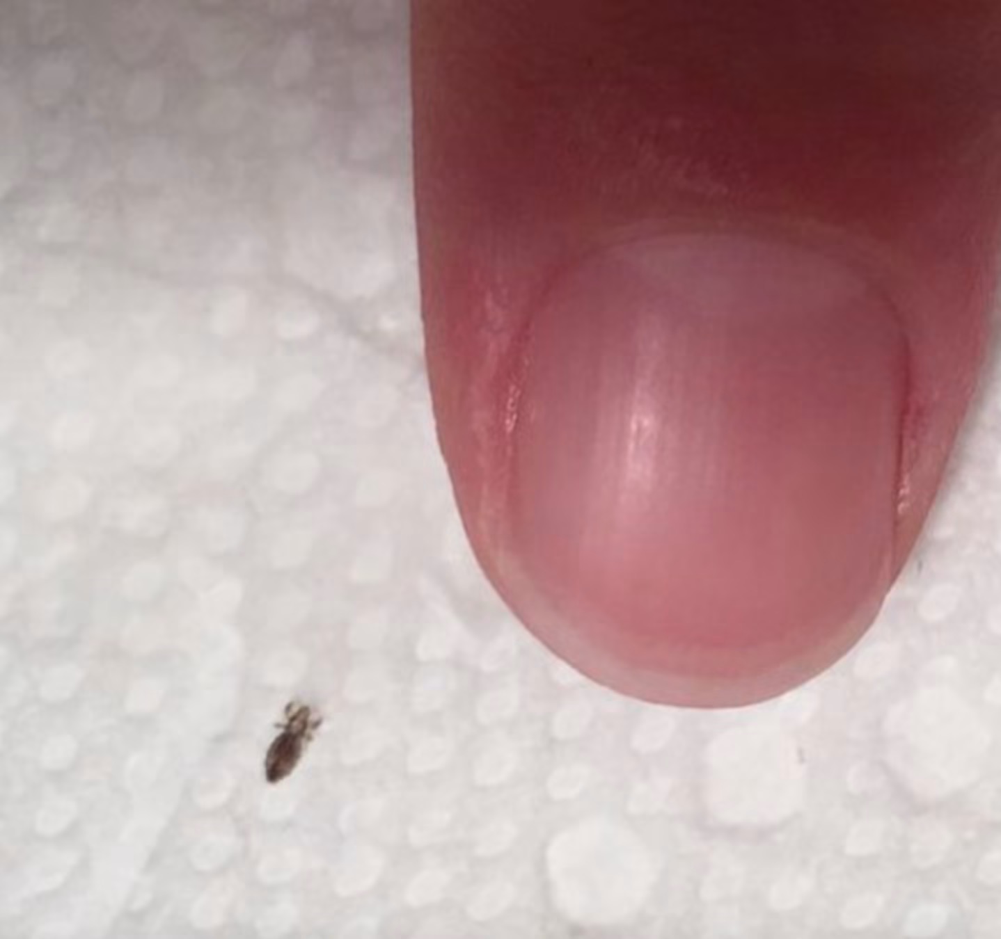 ”Wife found this in our toddler’s hair. Anything we should worry about? He goes to daycare 3 times a week 😮”