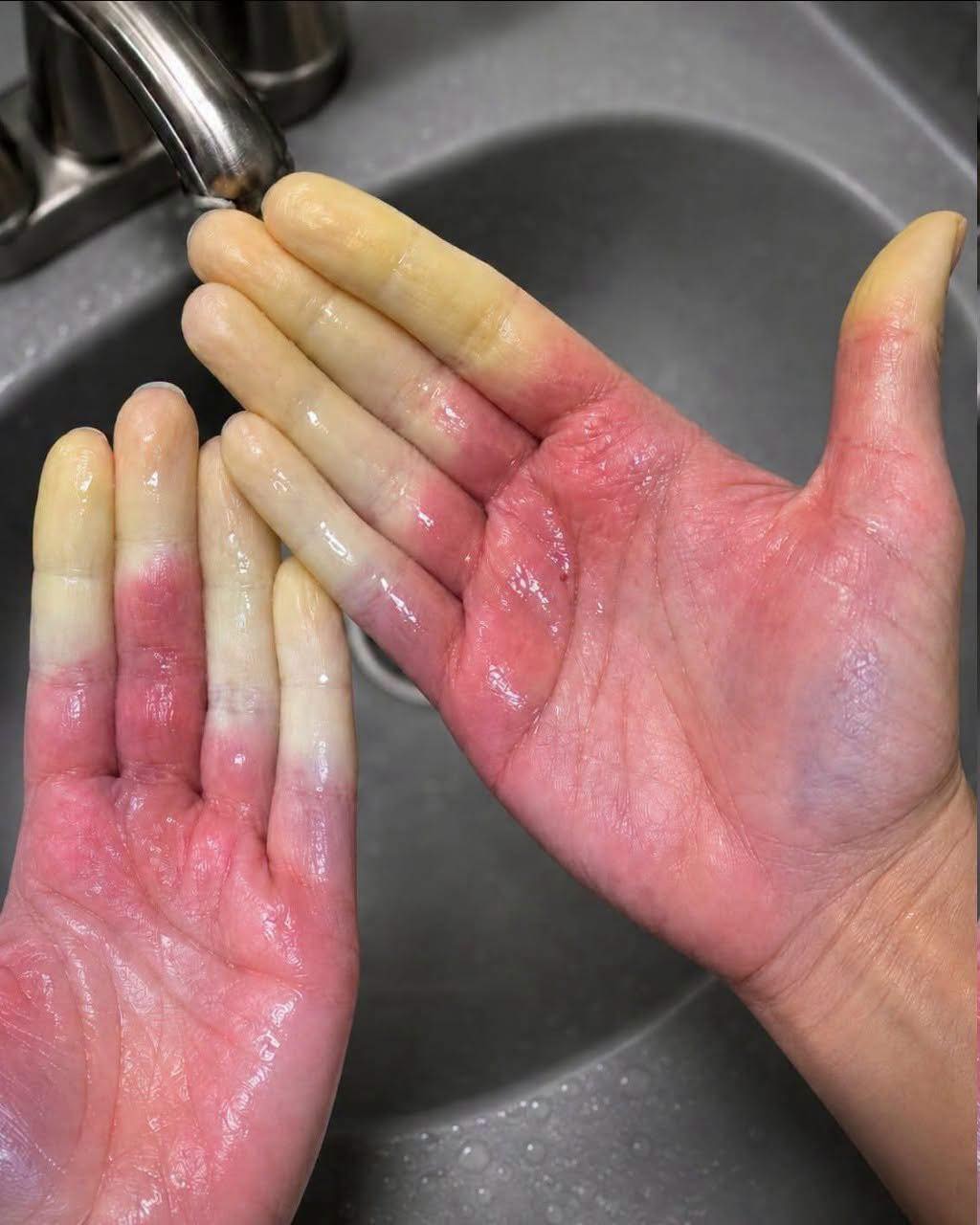 These are the consequences of sleeping with the…See more