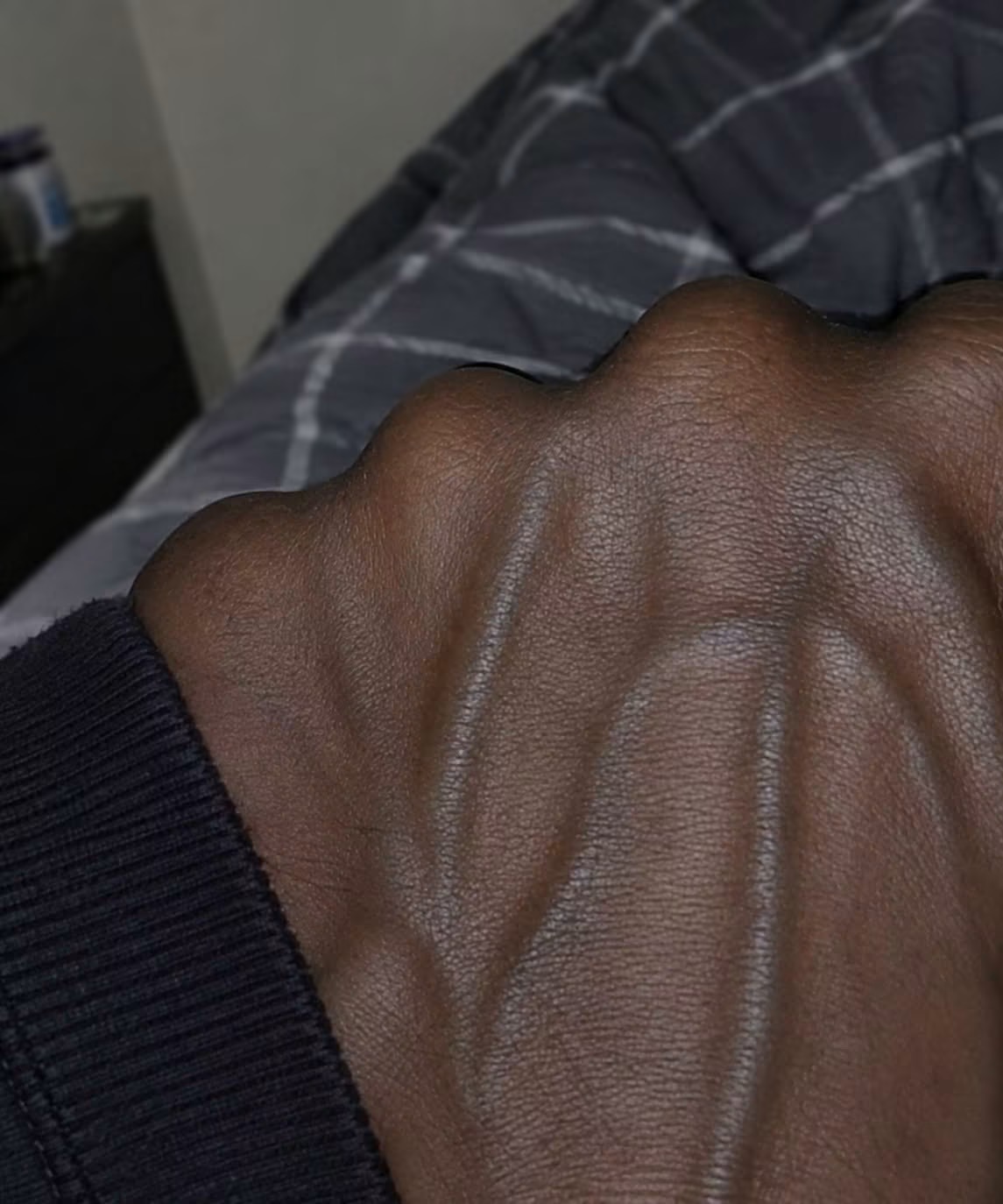 If the veins in your hand are visible, it may be a sign of ca… See more