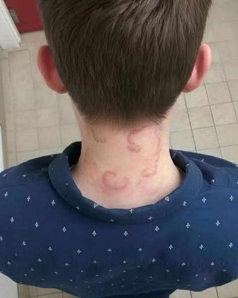 My 8-Year-Old Has Been Dealing With This for 2 Months – It’s Only Getting Worse 😟 What Could It Be?