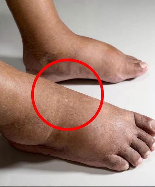 These are the consequences of sleeping with… See more