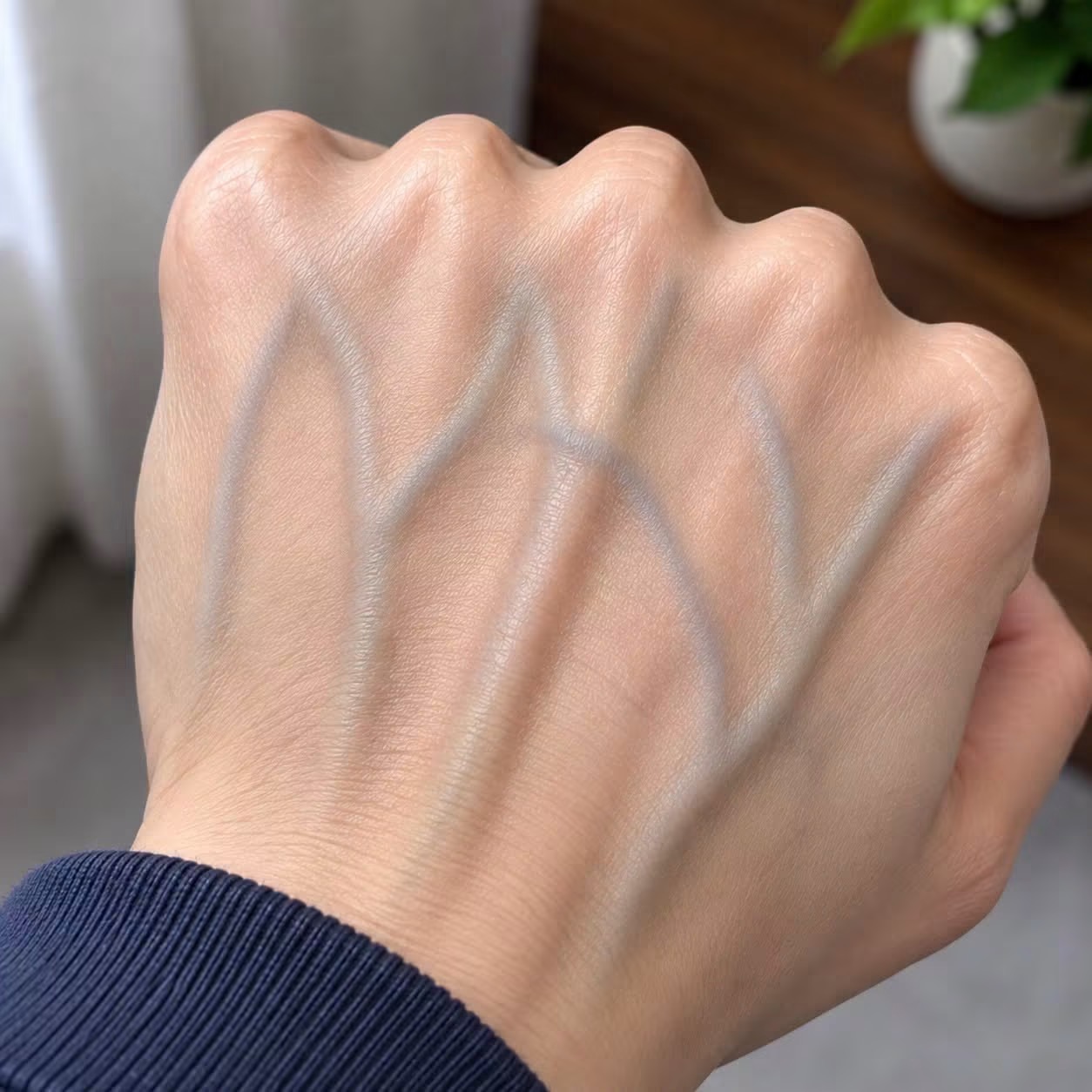 If your veins are visible in your hand, it is a signal of ca…See more