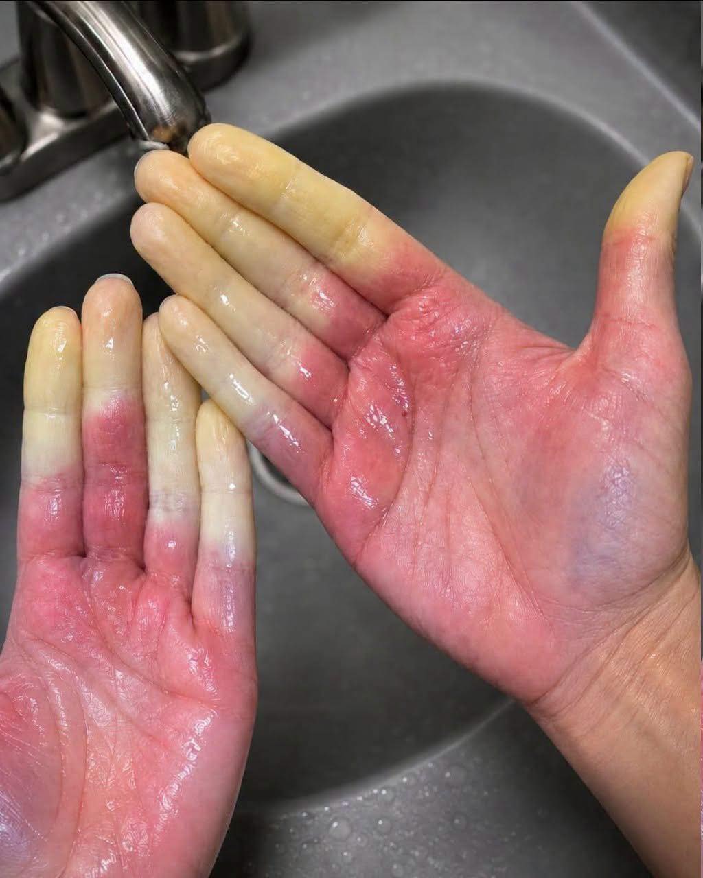 These are the consequences of sleeping with the…See more
