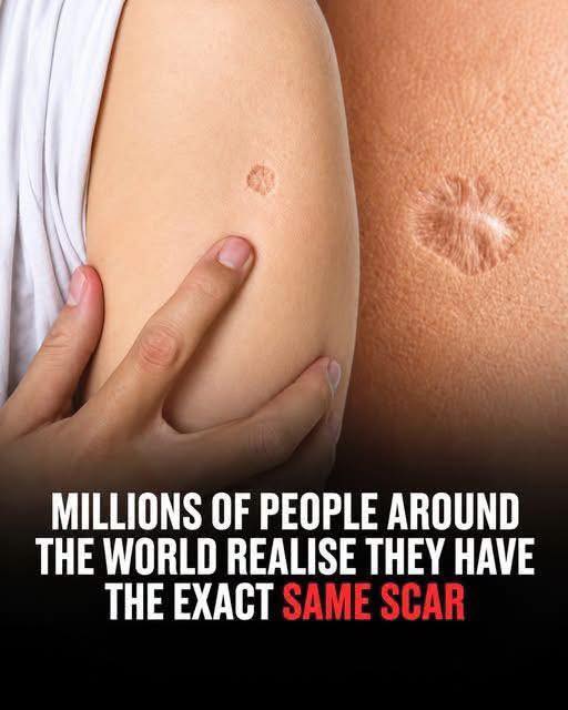 There’s a reason so many people have it 😳