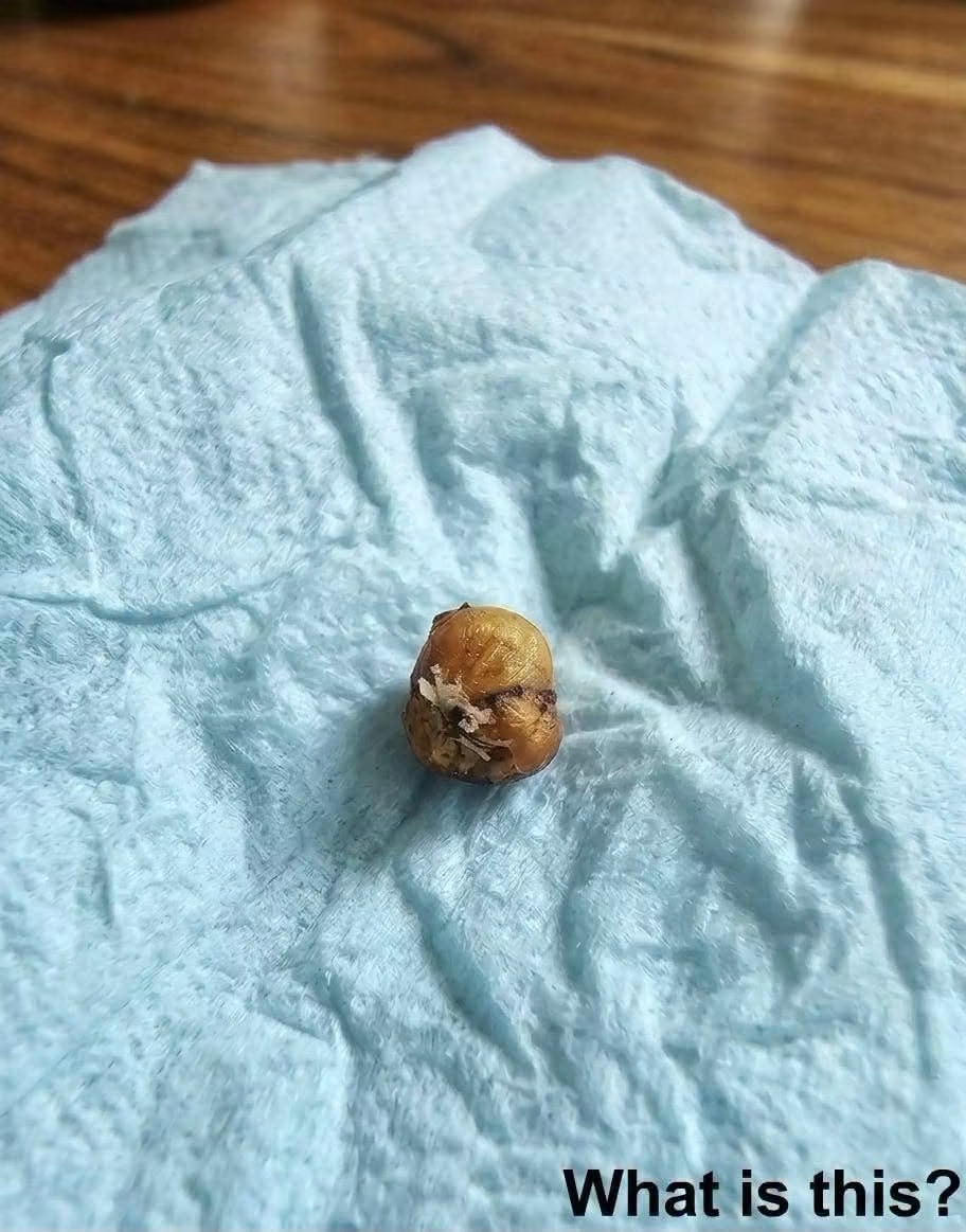 My girlfriend was washing her hair when this suddenly fell out of her head. It’s about 1 cm long. My girlfriend and I have been sitting here staring at it, trying to understand what it is. Does anyone know what this could be? Check the first comment for the answer 👇