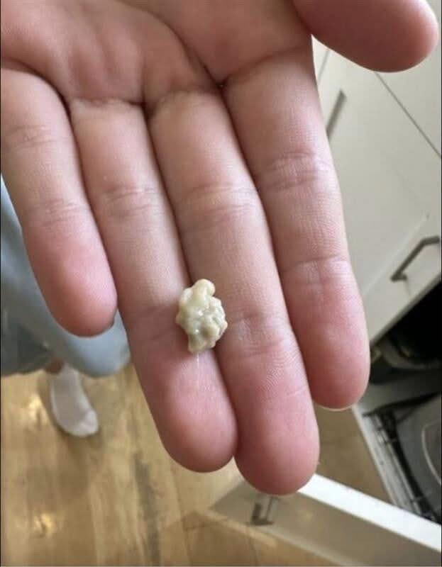 I sneezed 4-5 times yesterday and then felt something tickling my throat. Today, my throat is completely clear after this little thing came out. What is this? Well, you’d better know 😮 Check the comments 👇🏼